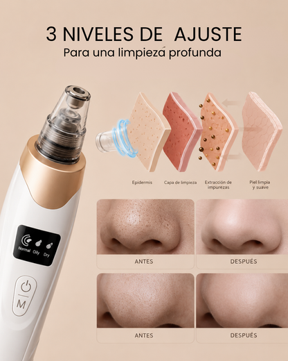 Avelier PoreLift